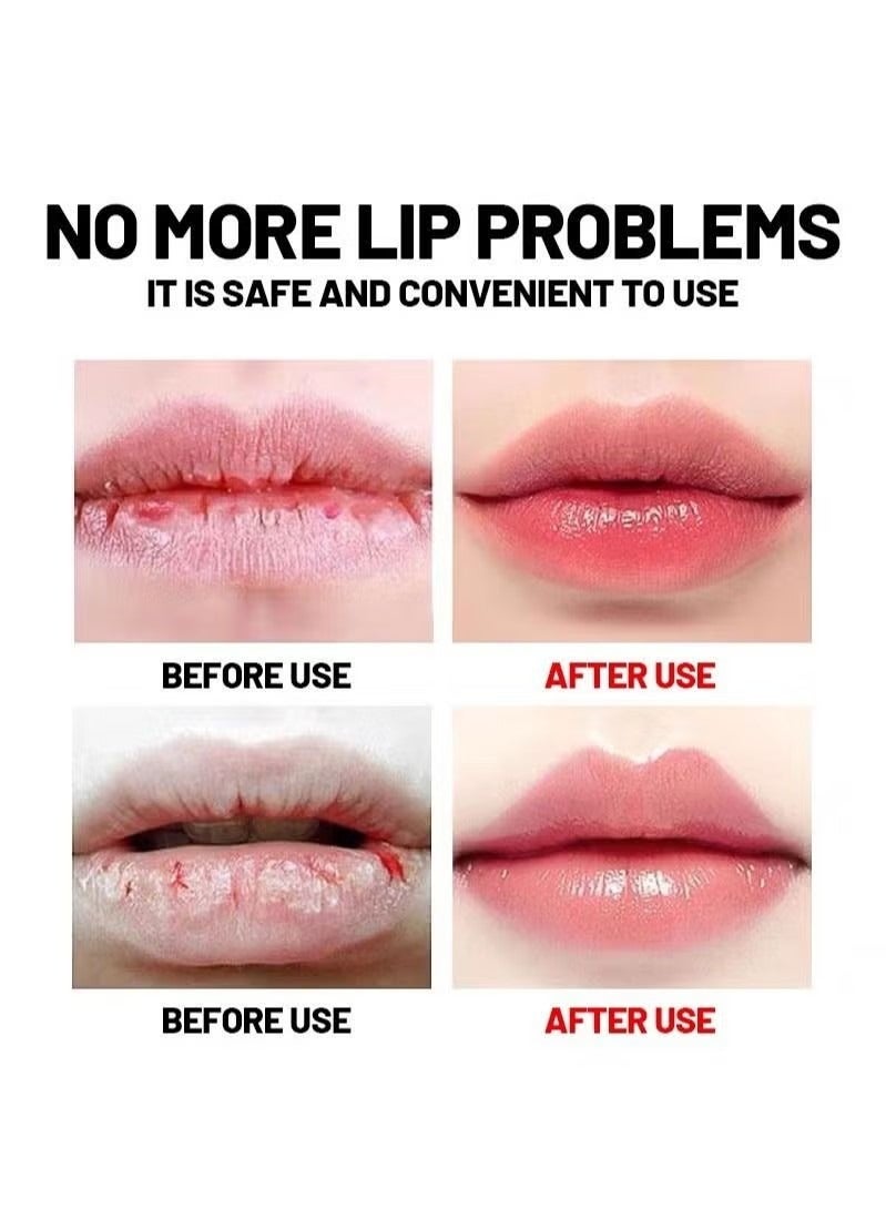 هيلموسز شفاه الإصلاح هلام لإصلاح وحماية شفاه الشقوق والجافة، مكونات طبيعية للتبريد الفوري وتخفيف الألم، إزالة الجلد الميت، خطوط شفاه تتلاشي، تحسين لون شفاه - Image 5