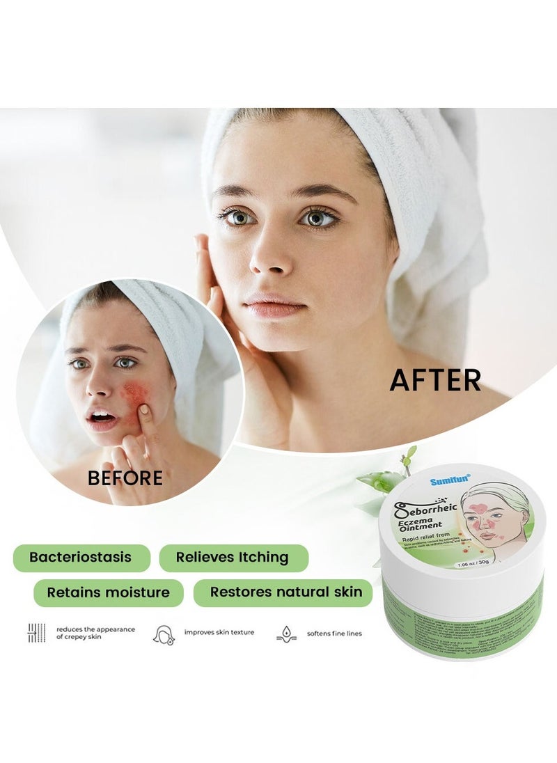 Sumifun Seborrheic Eczema Ointment Rapid Relief From Skin Problems Caused By Seborrheic Eczema, Such As Redness,Itching And Faking 30g - Image 3