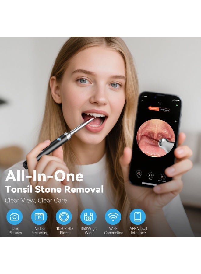 M MIAOYAN WiFi Visual Tonsil Stone Remover Kit, 1080P HD Oral Endoscope Camera with 5 Stainless Steel Tips, Tonsil Stone Removal Tool for Smartphone - Image 2