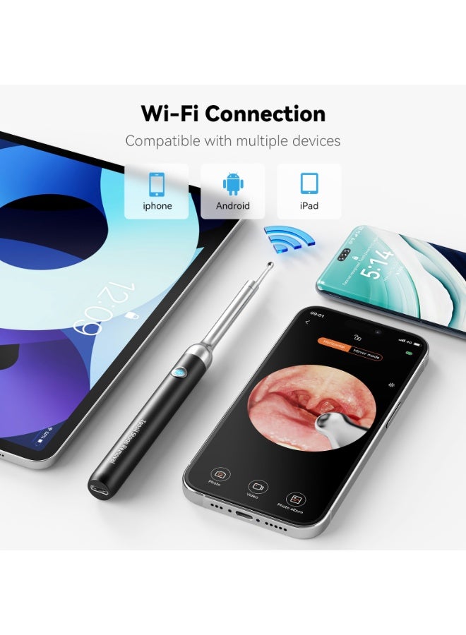 M MIAOYAN WiFi Visual Tonsil Stone Remover Kit, 1080P HD Oral Endoscope Camera with 5 Stainless Steel Tips, Tonsil Stone Removal Tool for Smartphone - Image 3