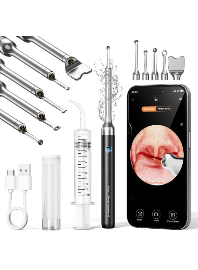 M MIAOYAN WiFi Visual Tonsil Stone Remover Kit, 1080P HD Oral Endoscope Camera with 5 Stainless Steel Tips, Tonsil Stone Removal Tool for Smartphone - Image 1