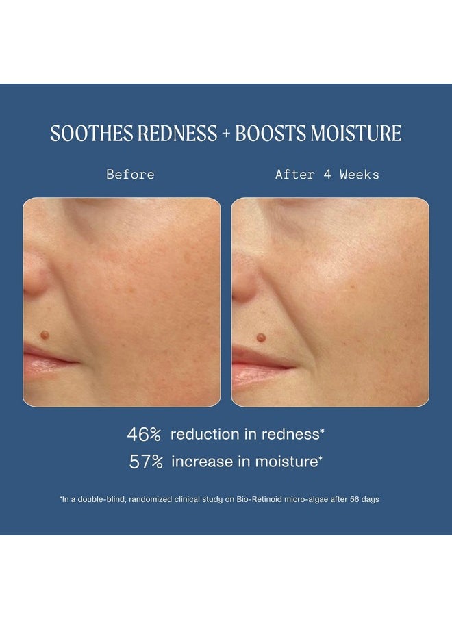 Kinship Dreamwave 2% Bioretinoid Overnight Renewal Serum Retinol For Sensitive Skin Smooth Wrinkles Niacinamide + Tranexamic Acid Brighten Moisturize Reduce Redness (1 Oz)  - Image 5