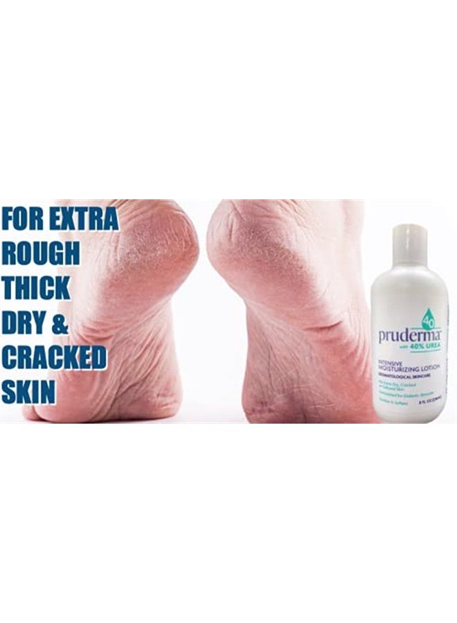 pruderma Urea 40 Lotion - Moisturizes & Rehydrates Thick, Cracked, Rough, Dead & Dry Skin - For Feet, Elbows and Hands - 8 oz - Image 3