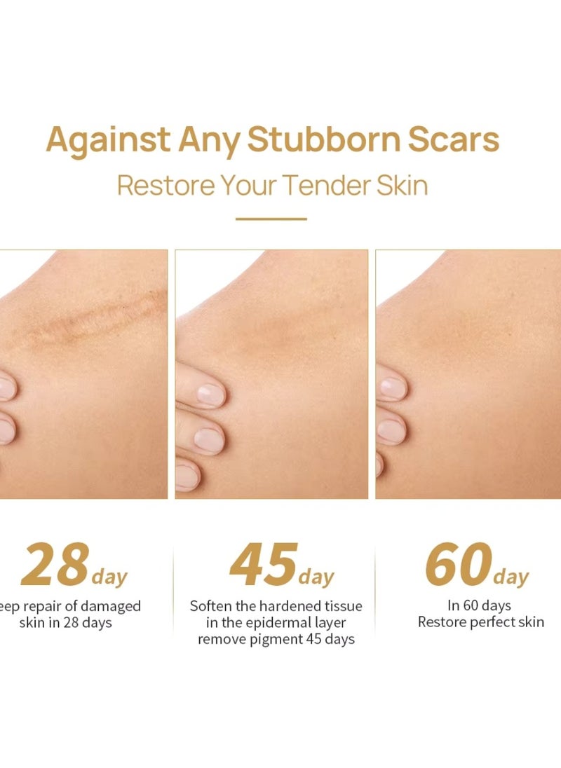 LANBENA - Skin Care Gel Skin Care Gel Fade Scars Stretch Marks Burns Repair Cream Face Skin Spots Marks Scar Removal Cream Shrink Pores Gel Old and New Scar Skin Repair Gel - Image 1