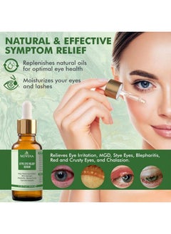 Stye Eye Relief Serum | 100% Herbal Essential Oils For Blepharitis Treatment Dry Eye Chalazion Eyelid Bumps & All Eye Irritations Gentle Lash And Eyelid Cleanser Sciencebased & Natural (20 Ml) - pzsku/Z75406350195DAC6BBA4DZ/45/_/1686397409/d733fa23-bd72-4fe9-a188-906364565d2e