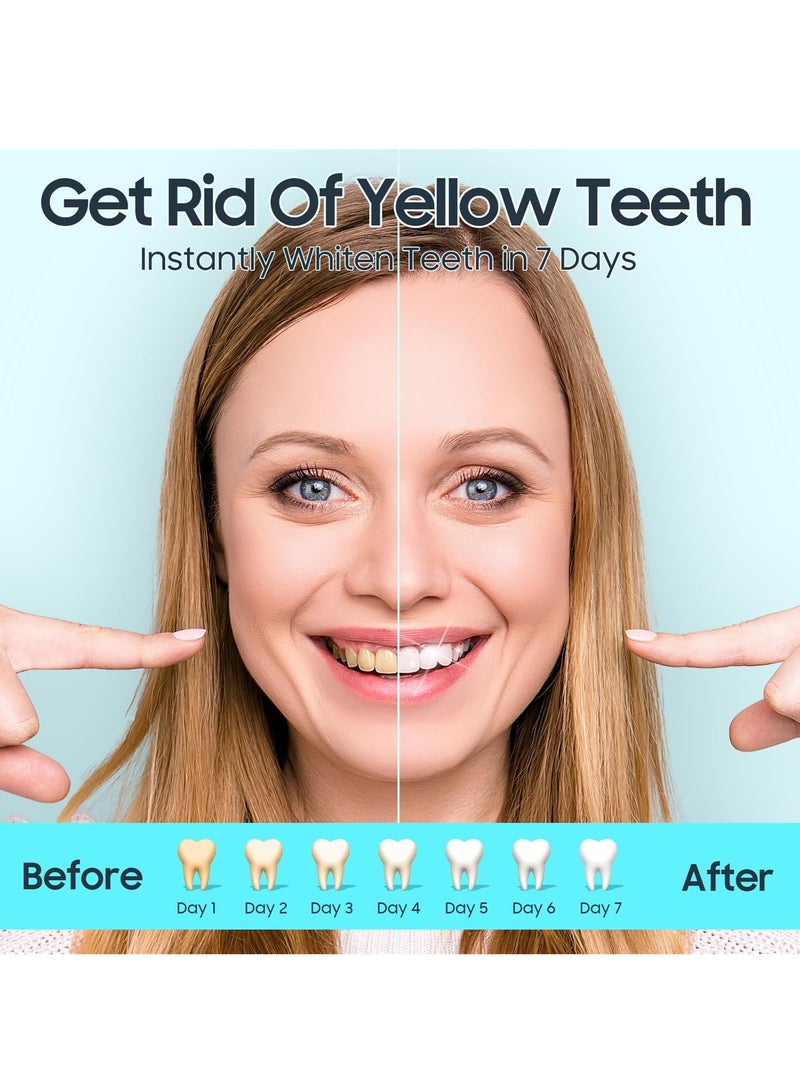 Generic 56 Pcs Whitening Strips, Teeth Whitening White Stripes Bleaching Teeth Stripes, Advanced No Slip Technology and Effective Stains Removal, Achieve a Whiter, Brighter Smile (28 Pairs, 56 Pcs)  - Image 2