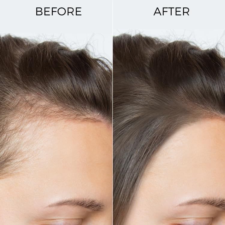 BRILLARE Pure Rosemary Essential Oil For Hair Growth 15 ml - Image 4