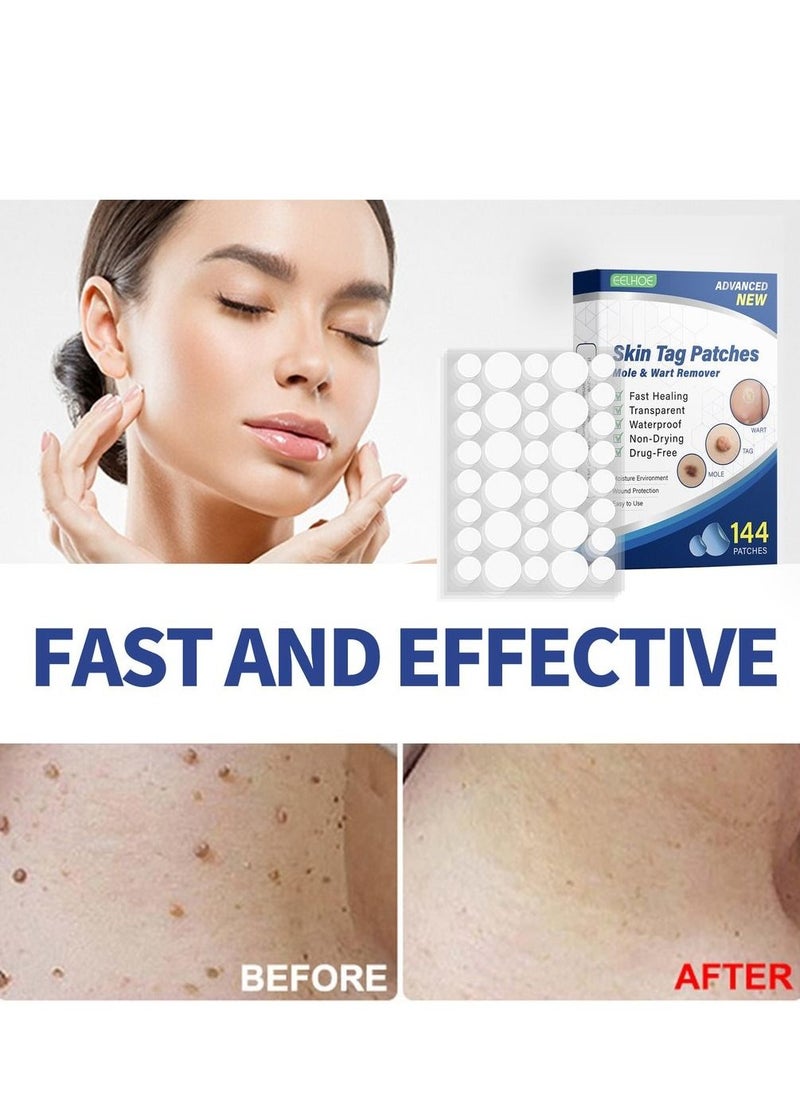 EELHOE - 144pcs/box Wart Removal Patches Mole Warts Removal Sticker Natural Ingredients Skin Tag Remover Stickers - Image 1