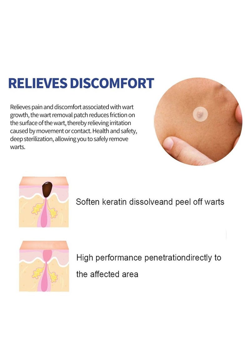 EELHOE - 144pcs/box Wart Removal Patches Mole Warts Removal Sticker Natural Ingredients Skin Tag Remover Stickers - Image 1