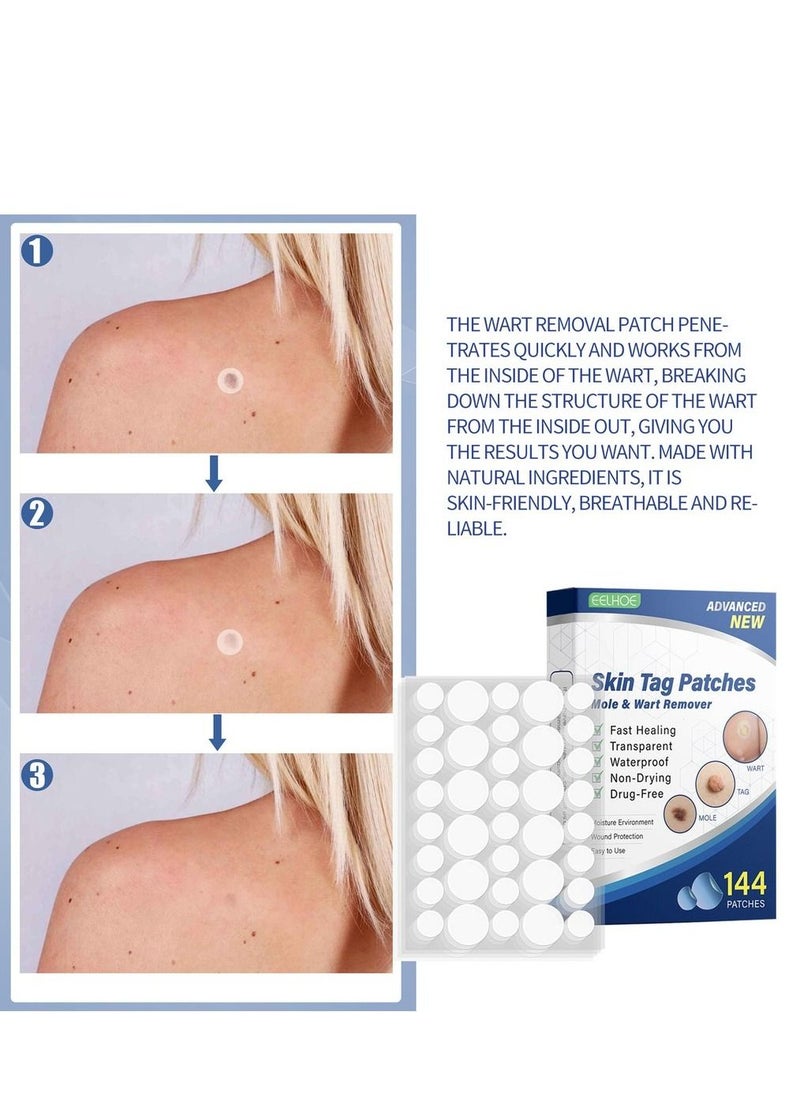 EELHOE - 144pcs/box Wart Removal Patches Mole Warts Removal Sticker Natural Ingredients Skin Tag Remover Stickers - Image 1