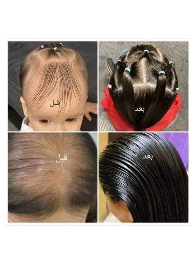 أتش دي زبدة الحليب لمعالجة - زيت معجزة للعناية بالشعر 225 جرام - Image 2