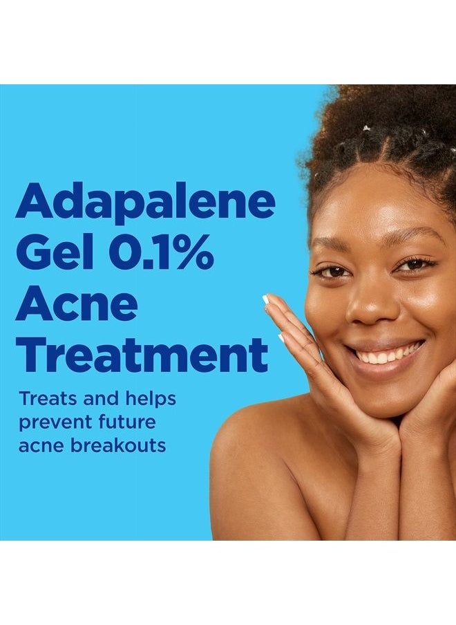 differin Acne Treatment Gel, 90 Day Supply, Retinoid Treatment for Face with 0.1% Adapalene, Gentle Skin Care for Acne Prone Sensitive Skin, 45g Pump (Packaging May Vary)  - Image 3