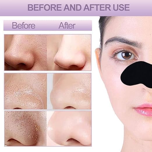 Generic Nose Strips Blackhead Remove Purifying Pore Strips Nose Strips Charcoal Nose Pore Strips Cleansing Remove Blackheads Cleaning 10 PCS  - Image 4
