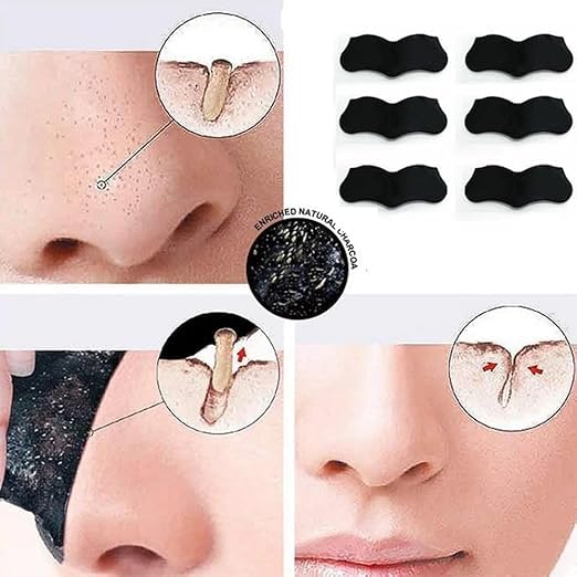 Generic Nose Strips Blackhead Remove Purifying Pore Strips Nose Strips Charcoal Nose Pore Strips Cleansing Remove Blackheads Cleaning 10 PCS  - Image 5