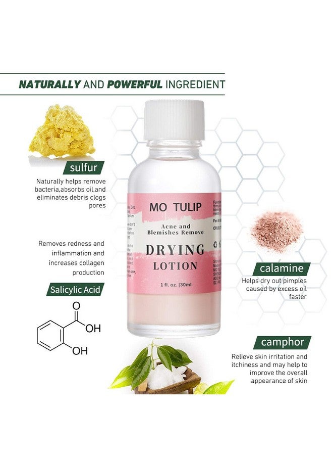 TUZIRUN Mo Tulip Acne Drying Lotion Overnight Acne Acid And Acne Spot Treatment For Face And Body Pimple Lotion Spot Treatment Dry Out Pimples Blemishes And Clean Pores (1Oz)  - Image 4