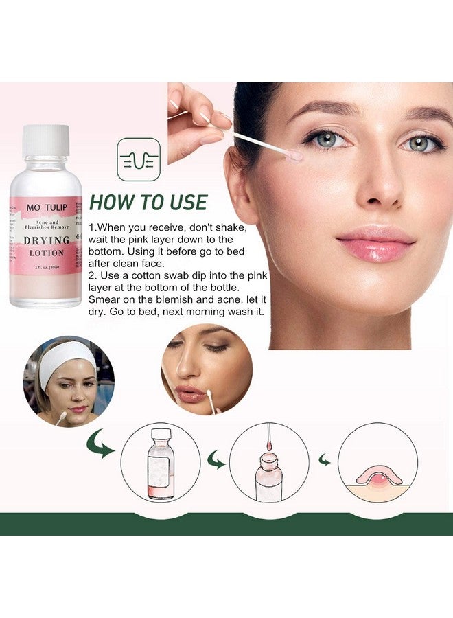 TUZIRUN Mo Tulip Acne Drying Lotion Overnight Acne Acid And Acne Spot Treatment For Face And Body Pimple Lotion Spot Treatment Dry Out Pimples Blemishes And Clean Pores (1Oz)  - Image 5