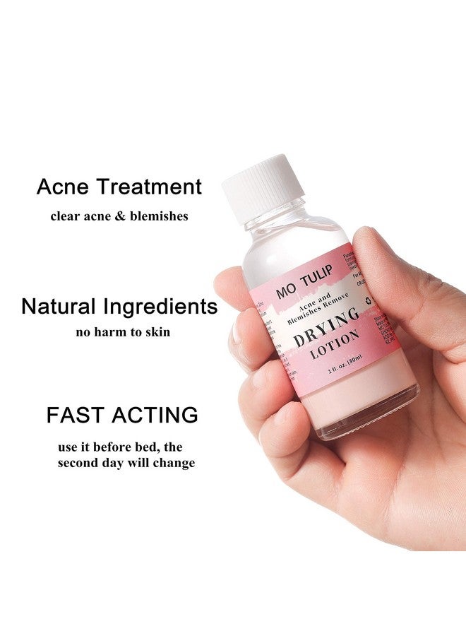 TUZIRUN Mo Tulip Acne Drying Lotion Overnight Acne Acid And Acne Spot Treatment For Face And Body Pimple Lotion Spot Treatment Dry Out Pimples Blemishes And Clean Pores (1Oz)  - Image 3