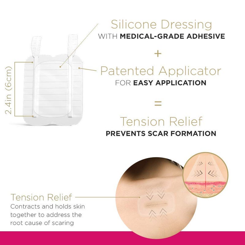 Embrace Active Scar Defense for New Scars, FDA-Cleared Silicone Scar Sheets, 2.4 Inch, Medium, 60 Day Supply (Recommended Treatment) - Image 2
