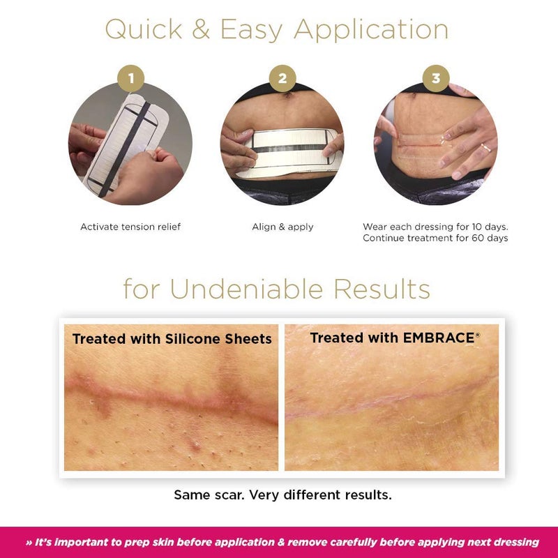 Embrace Active Scar Defense for New Scars, FDA-Cleared Silicone Scar Sheets, 2.4 Inch, Medium, 60 Day Supply (Recommended Treatment) - Image 4