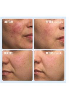 First Aid Beauty First Aid Beauty Ultra Repair Cream Intense Hydration Moisturizer for Face and Body – Strengthens Skin Barrier + Instantly Relieves Dry, Distressed Skin + Eczema – 6 oz + Bonus 1 oz Travel Size  - Image 2