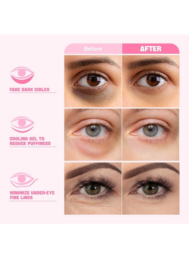 ZealSea ZealSea Under Eye Patches for Puffy Eyes and Dark Circles (Collagen, 20pairs), Anti-wrinkle Patches, Eye Bags Remover for Women, Eye Masks-Pads-Gels for Spa Party Christmas Gifts, Vegan Cruelty-Free - Image 2