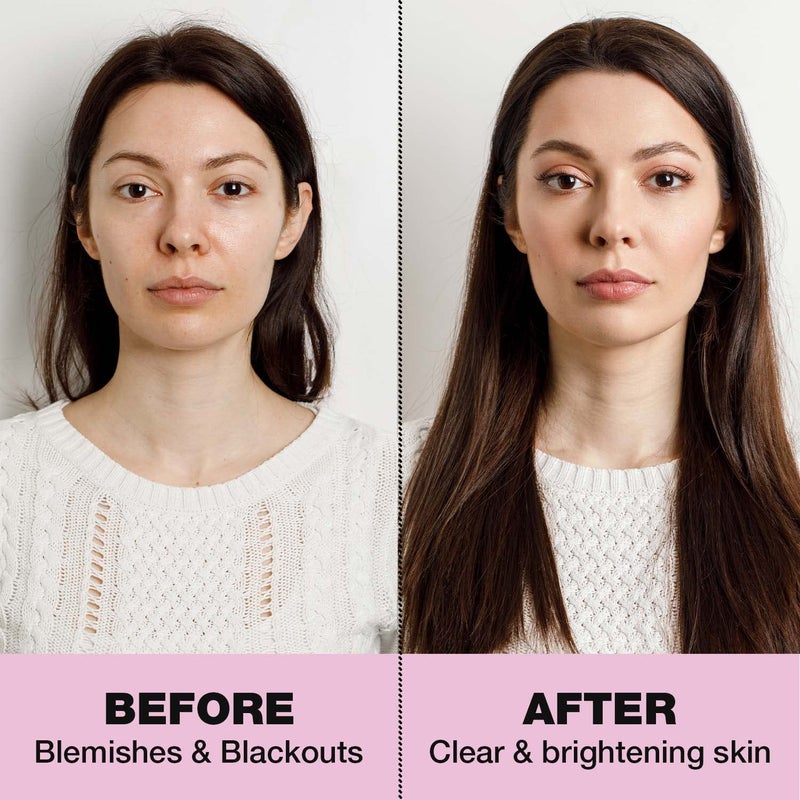 BellaCast Facial Drop for Clear and Glowing Skin 2 in 1 Formula CleanerMoisturizer Facewash 30 ml - Image 4