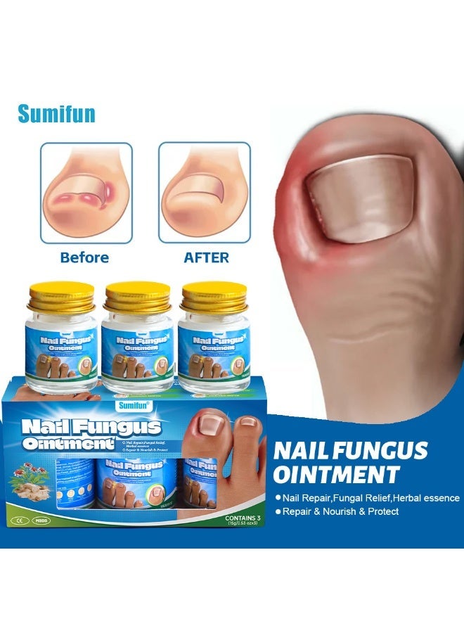 Sumifun 3PCS Nail Fungus Ointment,Extra Strength Nail Repair Cream, Toenail Fungus Treatment Cream, Cleans & Smooths Nails, Repairs Bacteriostatic 15g*3 - Image 1