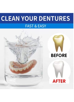 Jaysuing 100 Pcs Retainer Cleaner Tablets, Denture Cleaning Tablets 100 Tabs Mouth Guard False Teeth Cleaning Removes Odors Stains  - Image 4