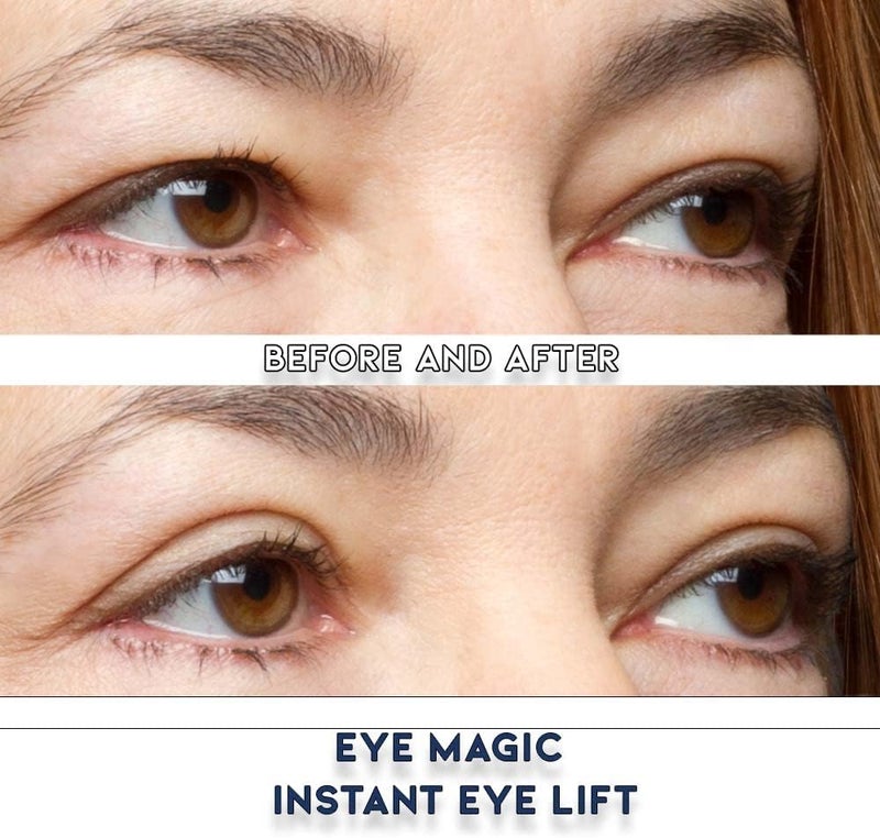Eye Magic Original Instant Eye Lift Kit for Drooping Eyelids - Small/Medium Size - Image 3
