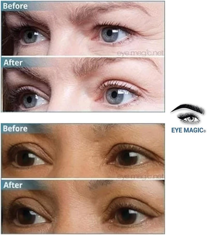 Eye Magic Original Instant Eye Lift Kit for Drooping Eyelids - Small/Medium Size - Image 5
