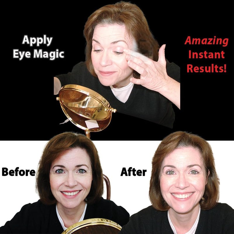 Eye Magic Original Instant Eye Lift Kit for Drooping Eyelids - Small/Medium Size - Image 2