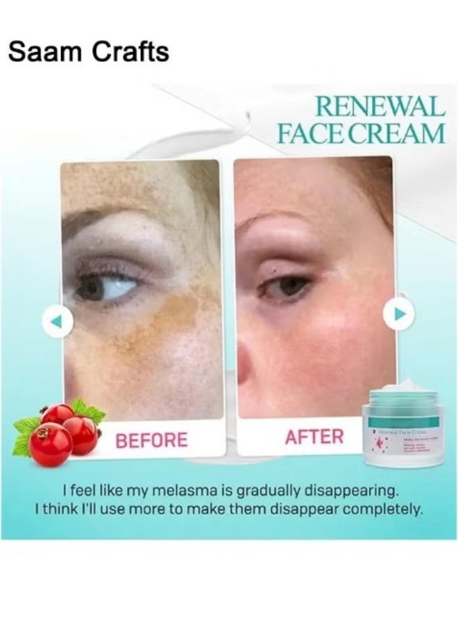 Saam Crafts Saam Renewal Face Cream, Saam Cosmetics Cream Dark Spots Cream, Saam Renewal Face Cream 50g For Melasma And Freckles Treatment For All Skin Types, Anti-Wrinkle Face Cream, Saam Face Cream Korean - Image 3