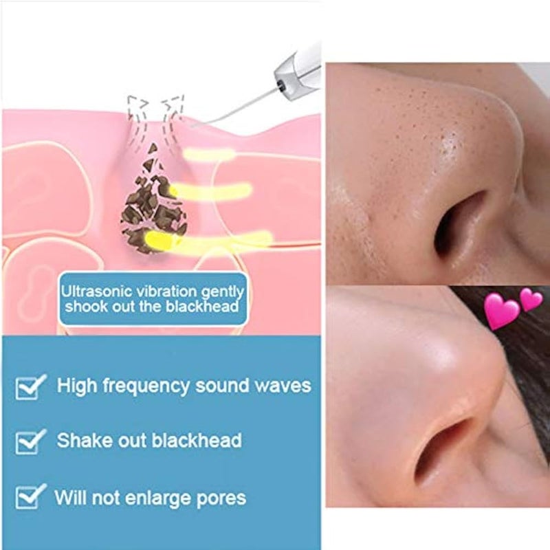 Brrnoo Ultrasonic Facial Cleansing Machine Facial Care Skin Exfoliator Blackhead Remover Facial Scraper Acne Extractor Deep Cleaning Facial Cleaning - Image 4