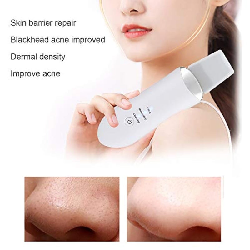 Brrnoo Ultrasonic Facial Cleansing Machine Facial Care Skin Exfoliator Blackhead Remover Facial Scraper Acne Extractor Deep Cleaning Facial Cleaning - Image 2