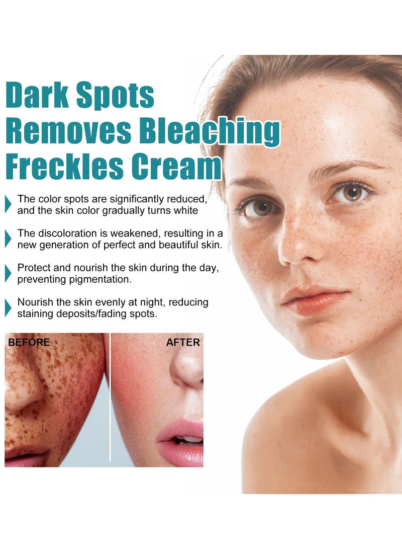 EELHOE Dark Spot Corrector Remover Cream Whitening Moisturizing Brighten Complexion Improving Skin Barrier 20g - Image 4