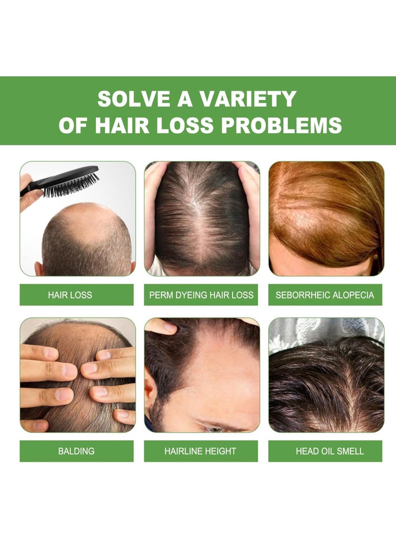 EELHOE 100 ml Rosemary Shampoo for Hair Growth, Rosemary Mint Shampoo, Vegan Shampoo Against Hair Loss, Helps Improve Hair Growth, Nourishes the Scalp, Stimulates Hair Growth - Image 4