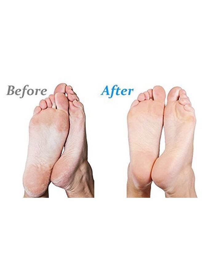 EMJOI Micro-Pedi 3D POWER Callus Remover with Xtreme Coarse Soft & Flexible Roller (Most Powerful & Corded) - Image 4