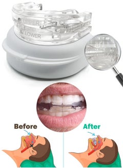 Anti-Snoring Mouth Guard Adjustable Mouthpiece Night Time Teeth Mouthguard Sleeping Bite Guard for Bruxism and Stop Snoring Custom Molding Adjustability, Snoring Reduction Aid for Men and Women