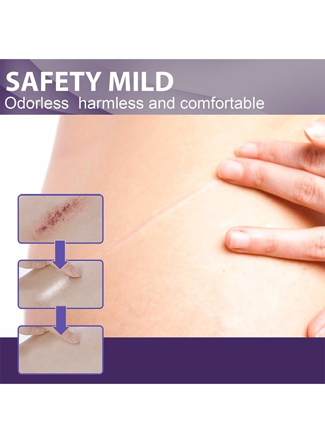 EELHOE Silicone Scar Sheet - Repair Patch,Improve Heal and Reduce Scars, Effective Treatment for Old and New Scars, FadePpregnancy Caesarean Section Scar Hyperplasia Sscar Silicone Repair Patch 8Pcs - Image 5