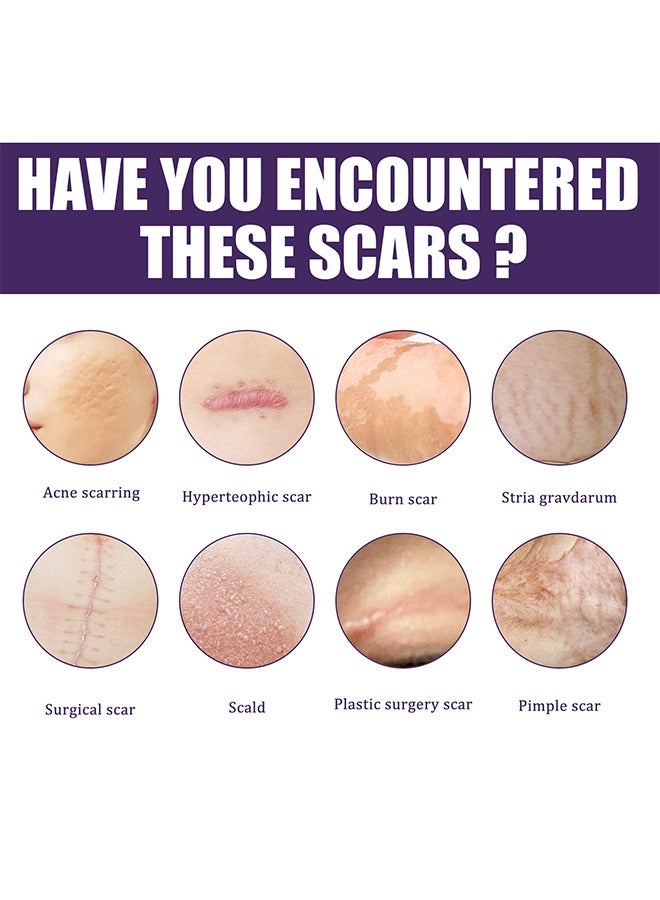 EELHOE Silicone Scar Sheet - Repair Patch,Improve Heal and Reduce Scars, Effective Treatment for Old and New Scars, FadePpregnancy Caesarean Section Scar Hyperplasia Sscar Silicone Repair Patch 8Pcs - Image 4