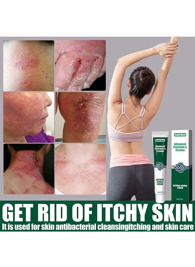SOUTH MOON - Advanced Psoriasis&Eczema Natural Herbal Cream，Organic Eczema Herbal Healing Cream, Chinese Herbal Eczema, Natural Herbal Cream, Psoriasis Ointment Cream, Moisturising Cream, Face Cream, Body Cream for Dry Skin, Itch Skin, Itch Relief Cream 20G - Image 1