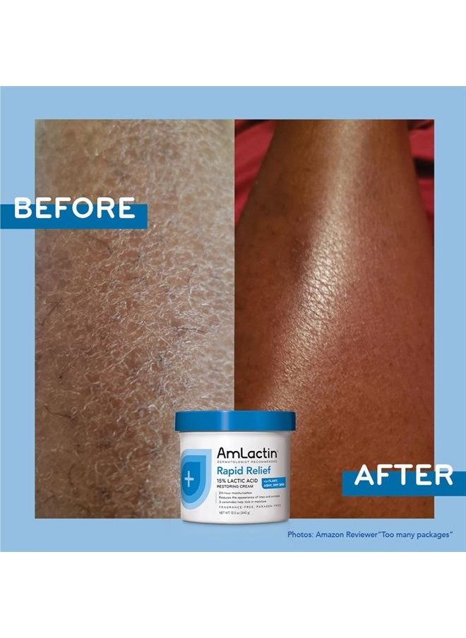 AmLactin - كريم الجسم العلاجي المكثف - عبوة 12 أونصة - مقشر ومرطب 2 في 1 للبشرة الجافة مع حمض اللاكتيك بنسبة 15% والسيراميد لترطيب لمدة 24 ساعة - Image 1