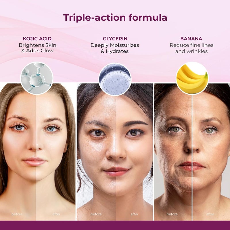 Kozicare Kojic Acid Banana Soap Body Tan Removal Soap Bath Soap for Men Women Reduces Dark Spots Hyperpigmentation For Glowing Skin Pack of 3 - Image 4