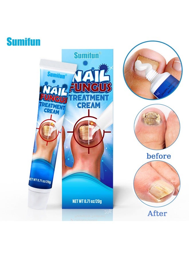 Sumifun Nail Fungus Treatment Cream, Bad Nail Care Ointment, Nail Fungus Treatment, Nail Growth and Repair, Nail Treatment Repair Cream  20g - Image 1