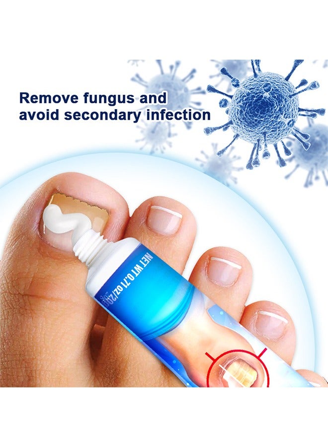 Sumifun Nail Fungus Treatment Cream, Bad Nail Care Ointment, Nail Fungus Treatment, Nail Growth and Repair, Nail Treatment Repair Cream  20g - Image 4