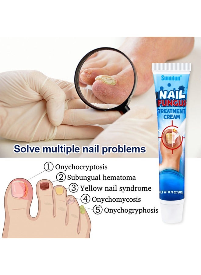 Sumifun Nail Fungus Treatment Cream, Bad Nail Care Ointment, Nail Fungus Treatment, Nail Growth and Repair, Nail Treatment Repair Cream  20g - Image 5
