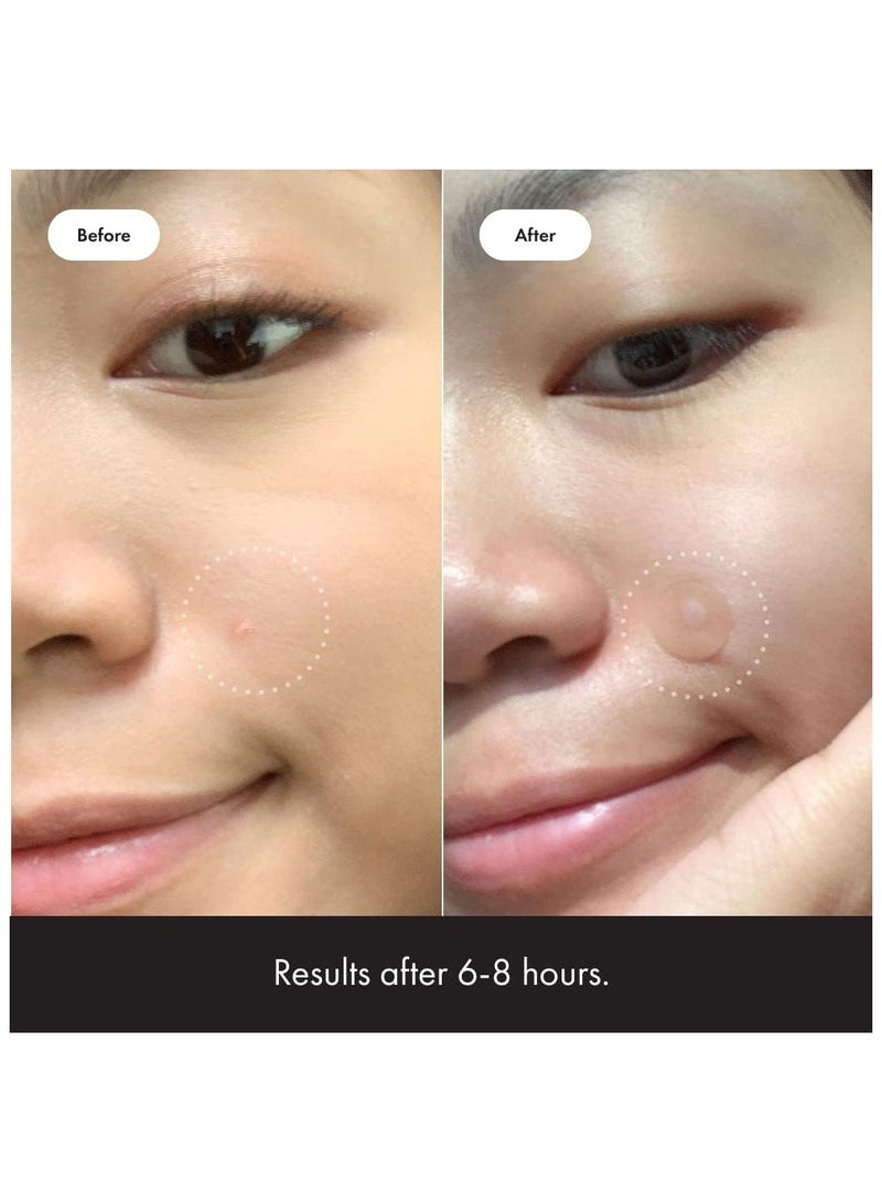 Mighty Patch Original - Hydrocolloid Acne Pimple Patch Spot Treatment (36ct) for. - Image 4