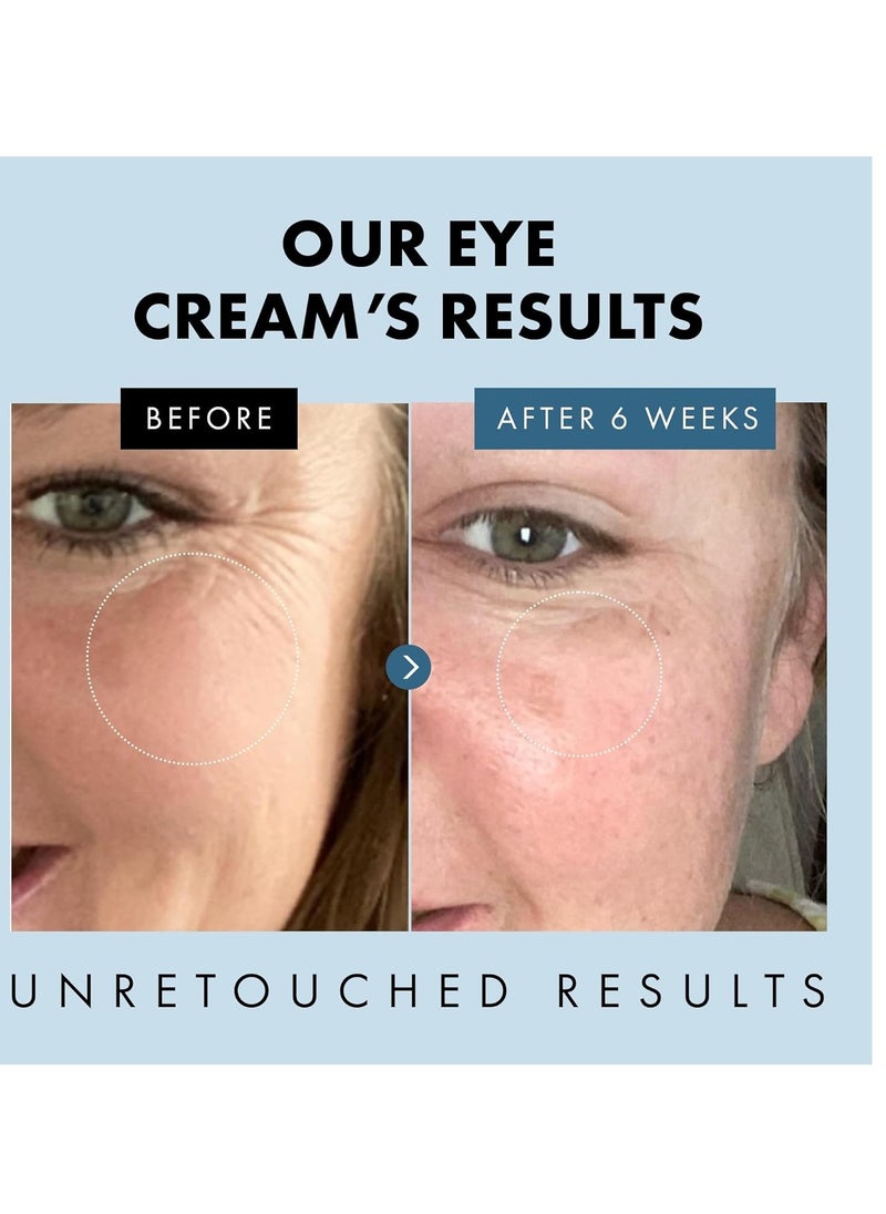 Eclat Skincare Eye Cream - 3X More Potent Encapsulated Vitamin E Anti-Ageing with Soothing Oat Extract, HA and Antioxidants  - Image 3