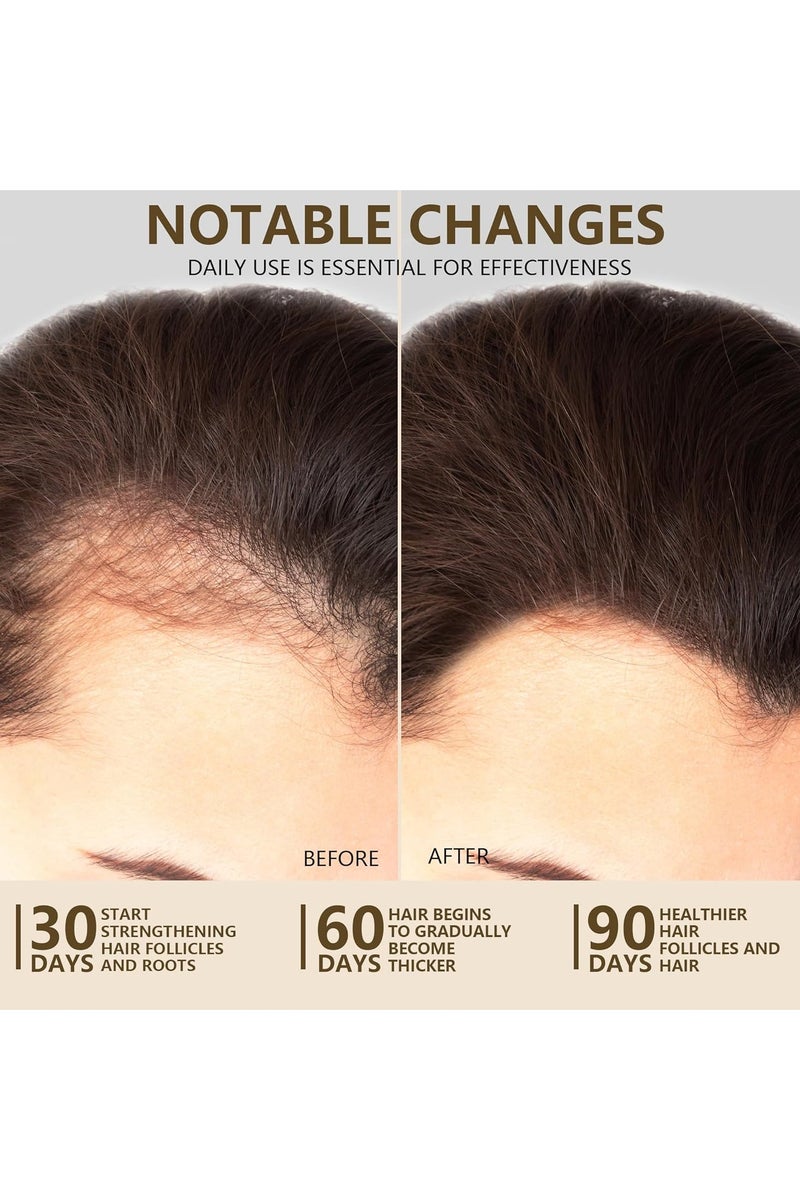 ATRJSZ 100% Natural Raw Batana Oil for Hair Growth, Unrefined & Organic Dr Sebi Hair Growth Oil From Honduras, Prevents Hair Loss, Eliminates Split Ends, Enhances Thickness 4.23 Fl Oz (Pack of 1) - Image 2