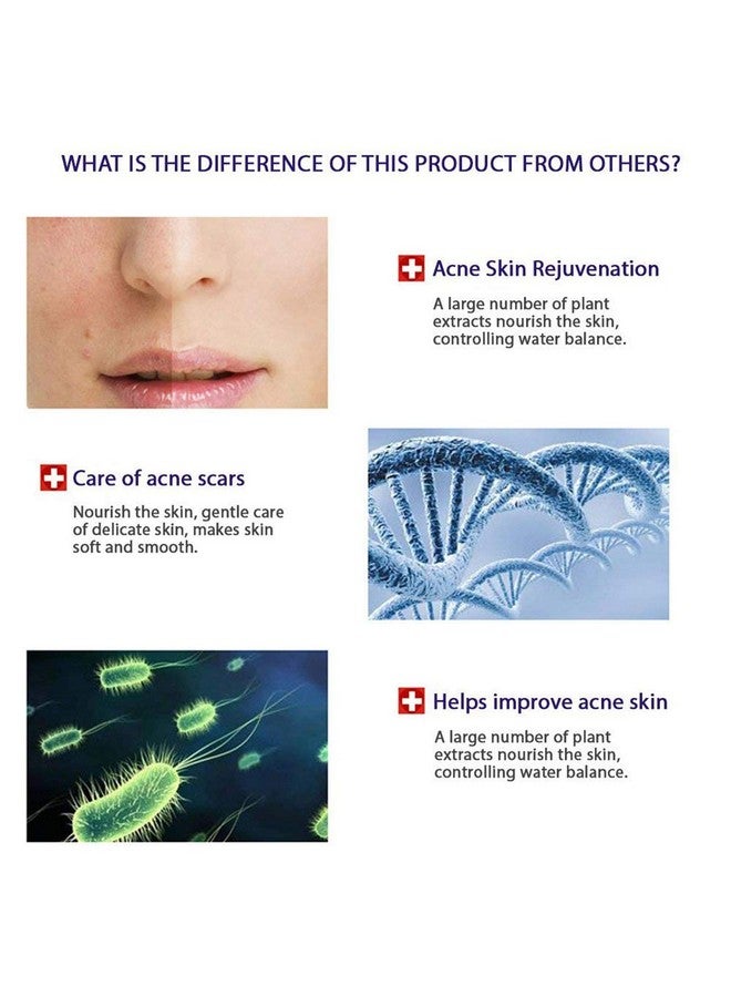 بيو أكوا 4In1 علاج حب الشباب وإزالة الندوب والبقع والبثور وكريم الزيت وأقنعة الوجه وعلامات العيب وزيت الترطيب 100 جرام + 30 جرام + 30 مللي + 4 قطعة X30G - Image 3